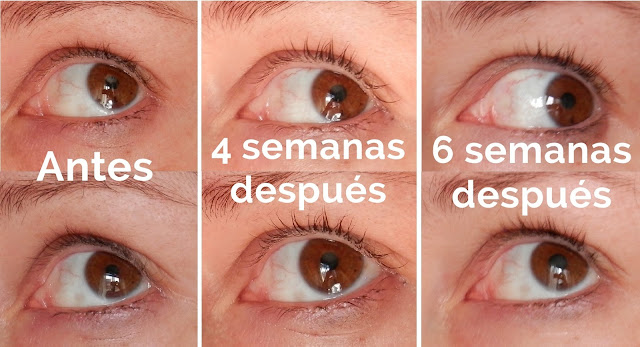 alargar pestañas antes despues serum alargar pestañas antes despues