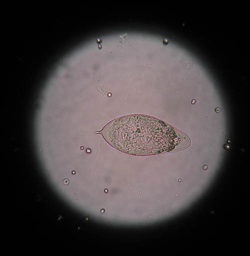 esquistosomas