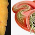 Con Estos 2 Ingredientes Vacié Todos los Depósitos de Grasa y Parásitos de mi Cuerpo Como si Nada