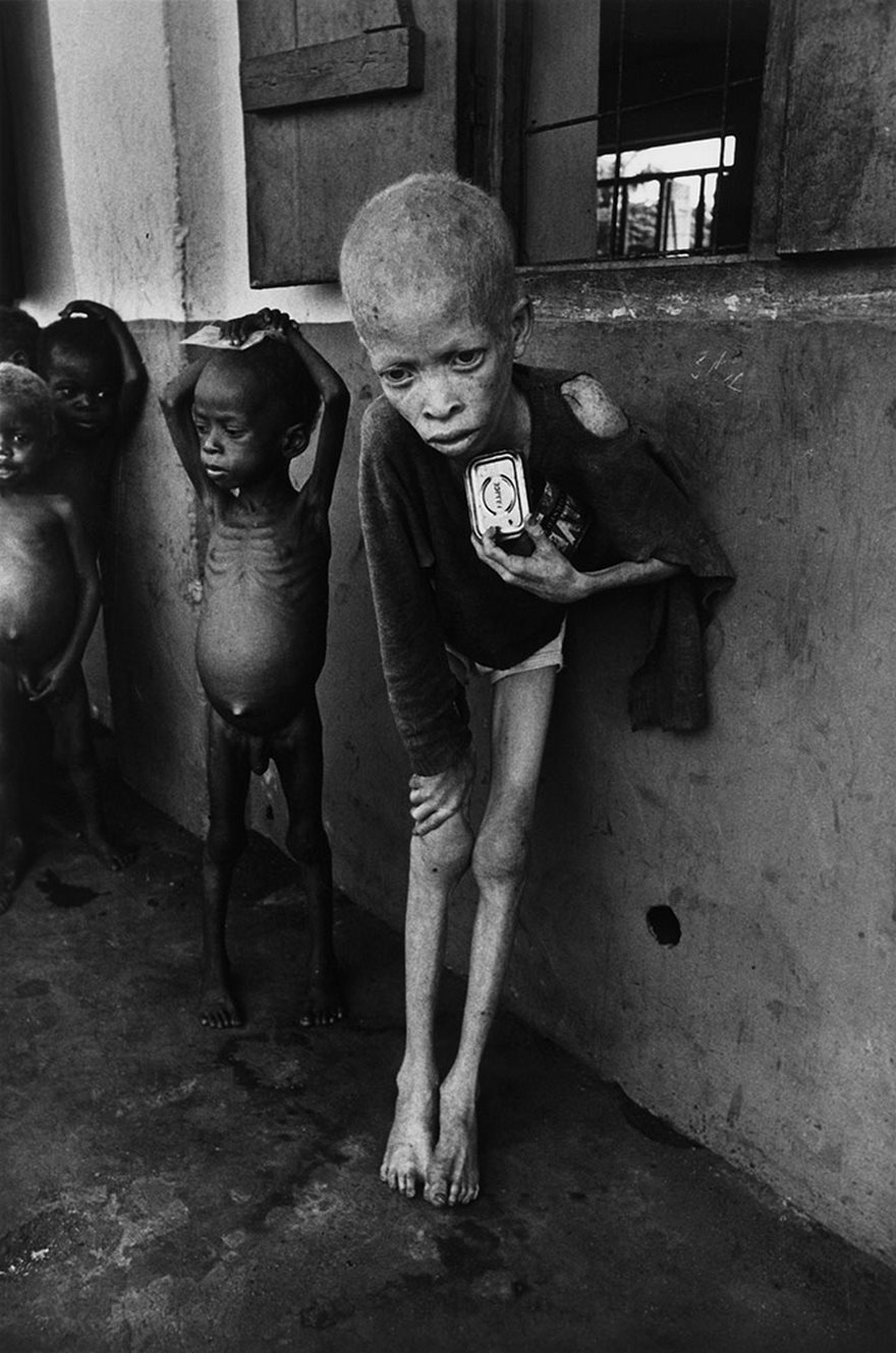 #17 Albino Boy, Biafra, Don Mccullin, 1969 - Top 100 Of The Most Influential Photos Of All Time #17 Albino Boy, Biafra, Don Mccullin, 1969 - Top 100 Of The Most Influential Photos Of All Time