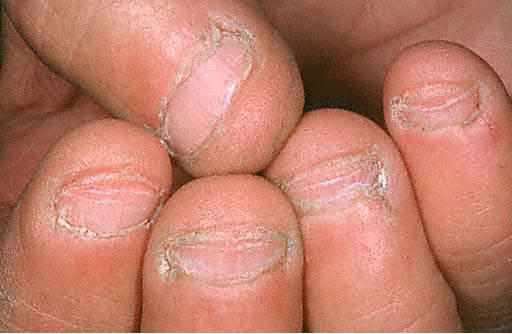 Bee Polished: Rehab Your Nails: What is a long nail bed?