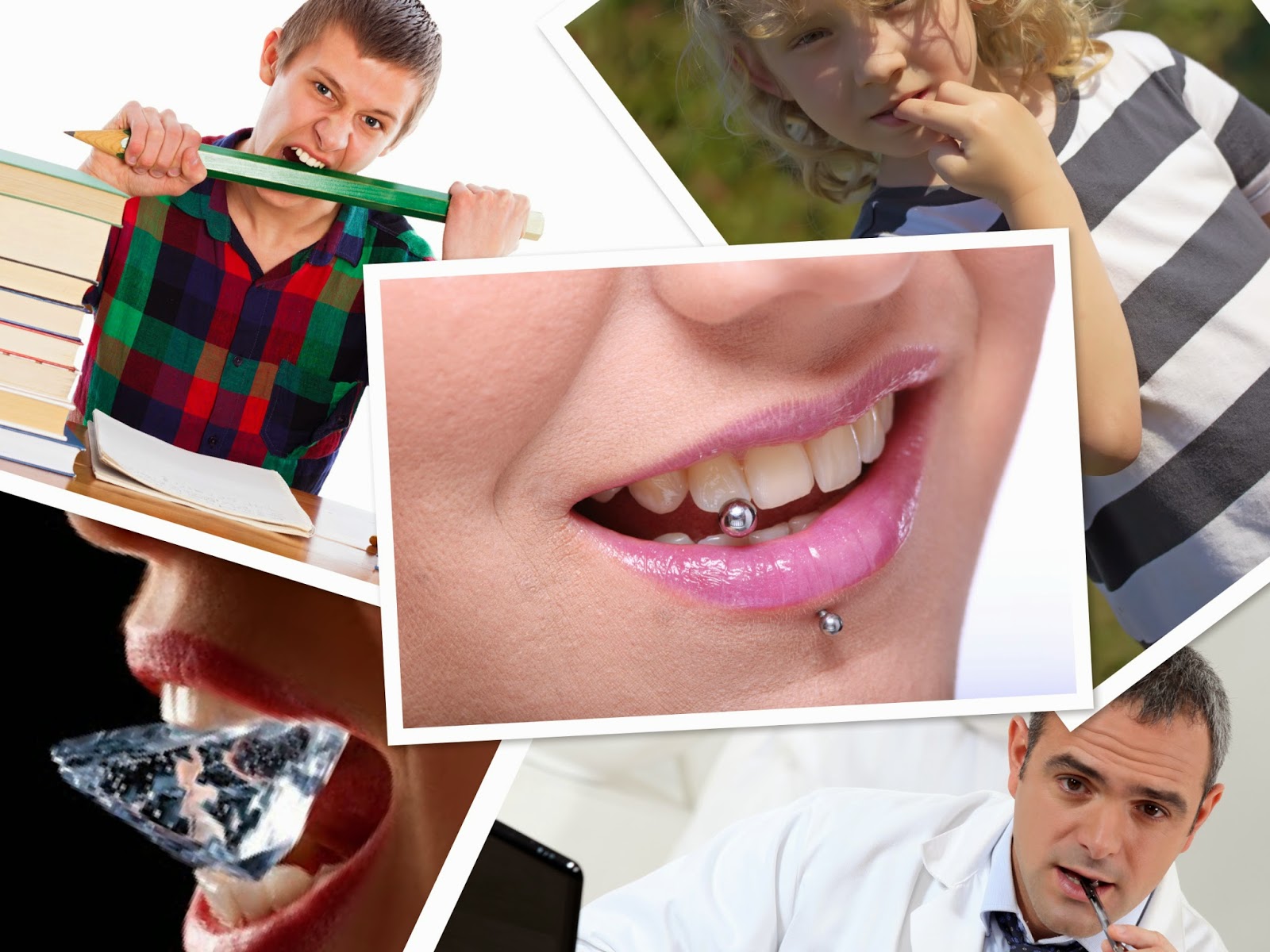 Nail Biting, Dentists in Brampton, Brampton Dental Office, Brampton Dentists,