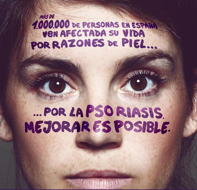 La psoriasi di fotografia comincia
