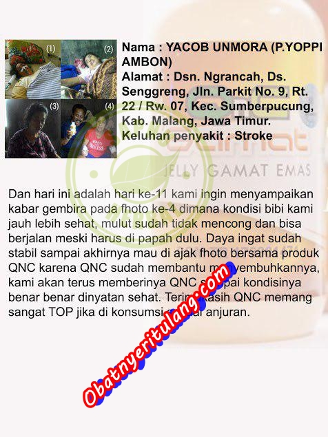 Cara Mengobati Stroke Ringan Atau Berat Secara Alami Terbukti Mujarab Cara Mengobati Stroke Ringan Atau Berat Secara Alami Terbukti Mujarab