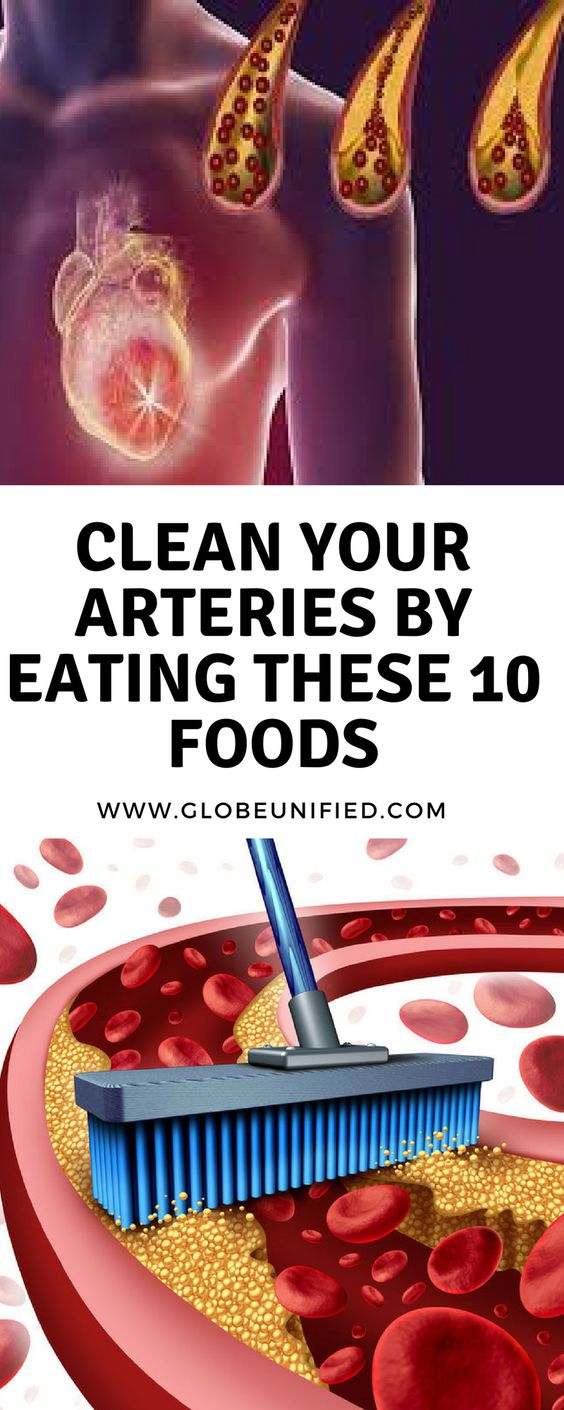 Clean Your Arteries By Eating These 10 Foods Health Pins