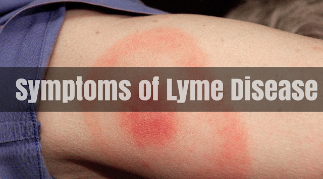 Symptoms of Lyme Disease