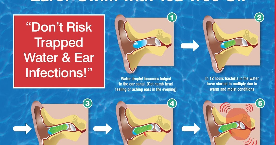 Tech Diving Malta Ear Problems?