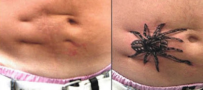 Imágenes hermosos de tatuajes para tapar, cicatrices, estrías, cesáreas, manchas Imágenes hermosos de tatuajes para tapar, cicatrices, estrías, cesáreas, manchas