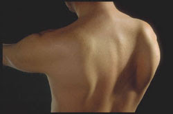 winging_scap_1.jpg
