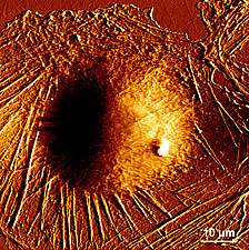 Imagen de fibroblasto obtenida mediante AFM Imagen de fibroblasto obtenida mediante AFM