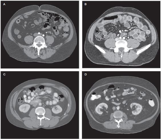 Gastrointestinal Contrast Media For CT Scan Study - RadTechOnDuty