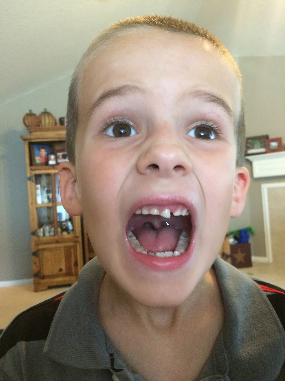 a DAY in the life Wiggly tooth...Stubborn tooth...