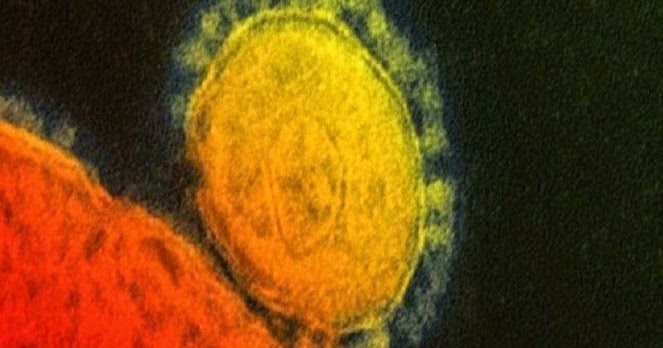 Virus Mers Penyebab Tanda Gejala Ciri-Ciri | Lionel Ngeblog