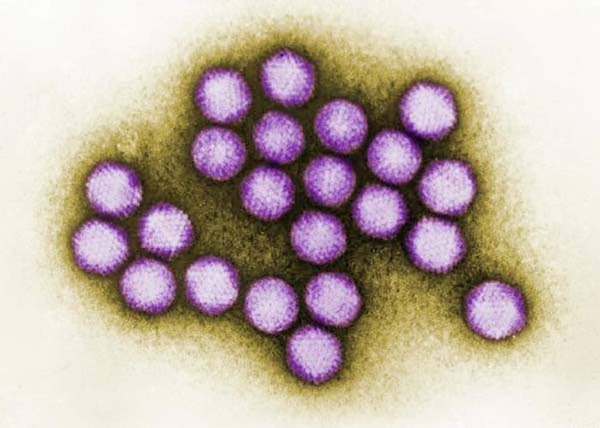 El brote de un virus severo, en un centro de rehabilitación de Nueva Jersey para “niños . El brote de un virus severo, en un centro de rehabilitación de Nueva Jersey para “niños .