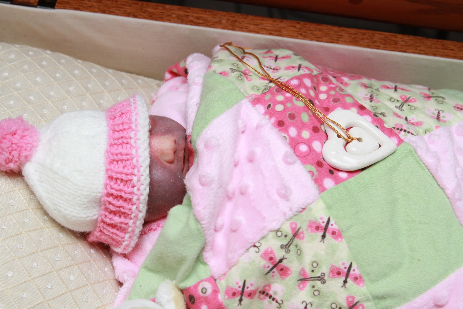 Baby Rachel's Legacy Open Casket