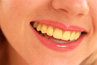 http://manfaatnyasehat.blogspot.com/2014/03/ketahui-penyebab-gigi-menjadi-kuning.html