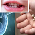 Don’t Throw Away Baby's Teeth; It Can Save Your Child’s Life