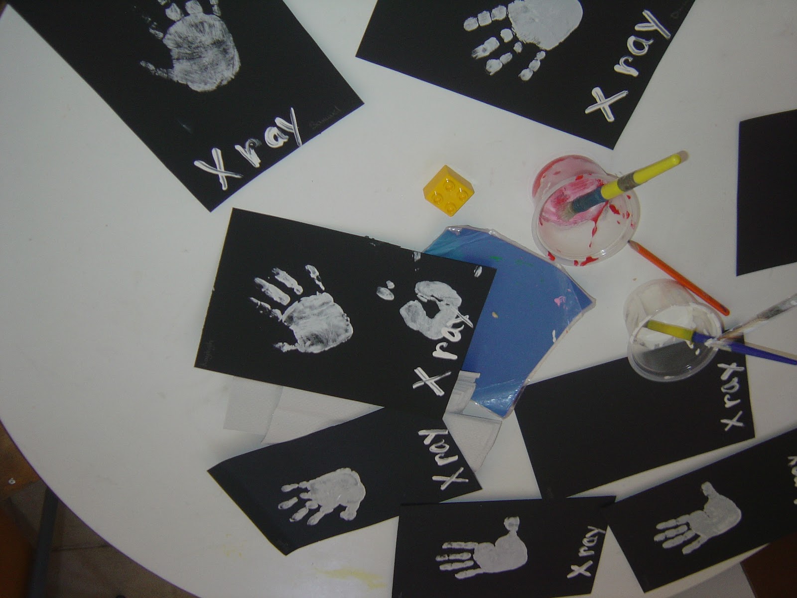 Kindergarten 1.5: X-ray