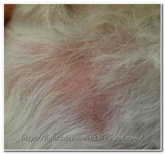 Dermatitis Treatment for Cats Let us Fight To DERMATITIS