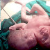 UN BÉBÉ À DEUX TÊTES MEURT QUELQUES HEURES APRÈS SA NAISSANCE.