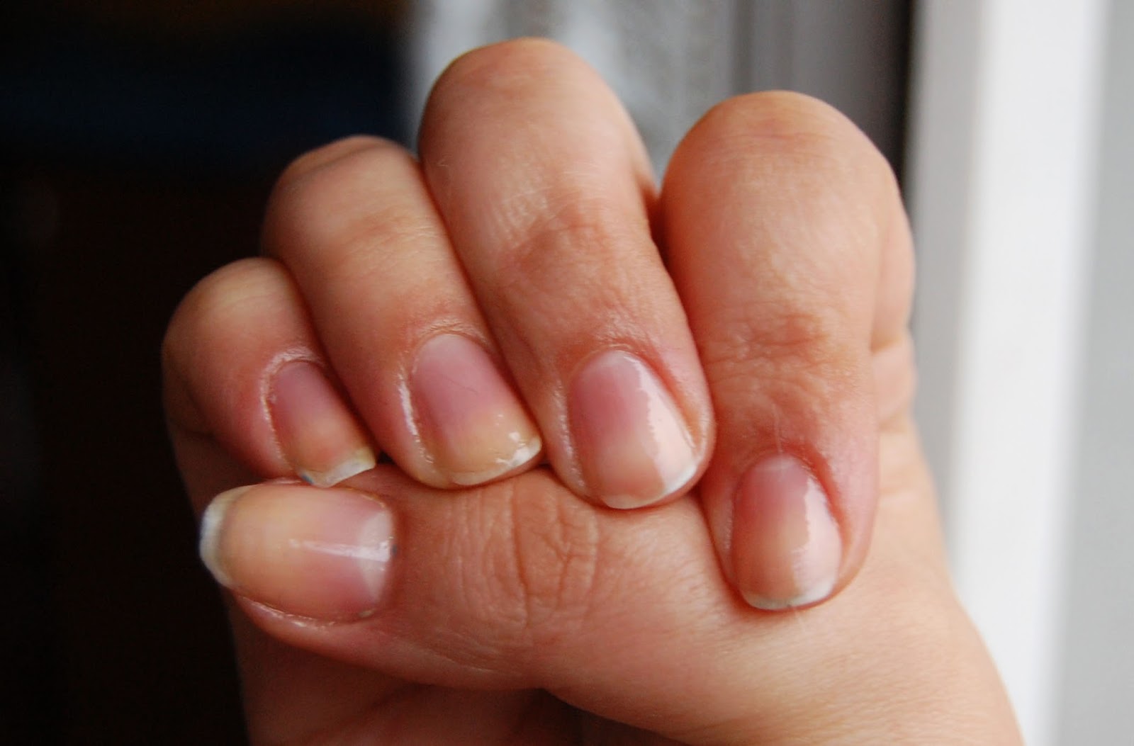 kuracja-nail-tek kuracja-nail-tek