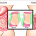 Get Rid Of Bloated Stomach With These 4 Natural Ways