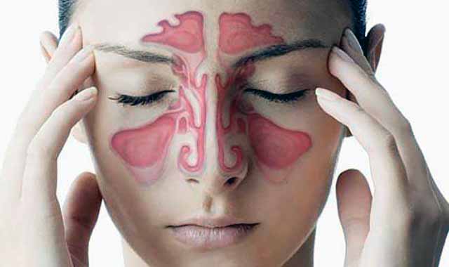 Synecologists in Homeopathy হোমিওপ্যাথিতে সাইনোসাইটিস চিকিৎসা