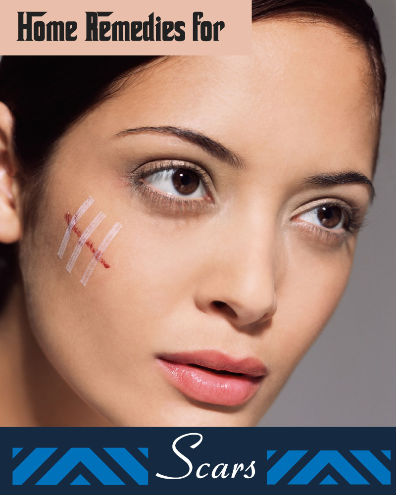 Home Remedies for Scars Current Healthy