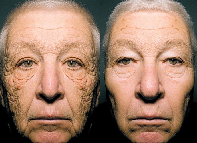 Clínica de comesticos en pánico 20 años de cualquier parte de tu cuerpo