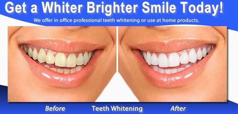 Omni Dental Group: At-Home Tooth Whitening Options