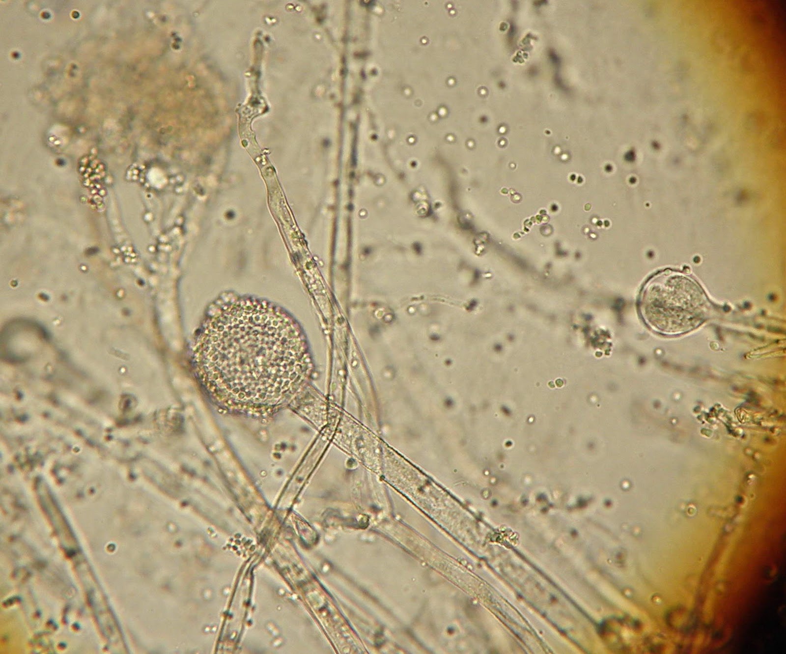 Споры гриба мукора. Клетки мукор микроскоп. Мукор микроскопирование. Мицелий мукора под микроскопом. Клетка плесени мукора.