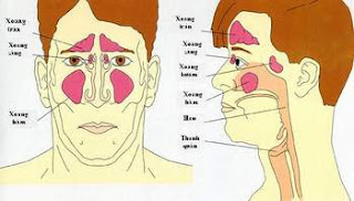 TRIỆU CHỨNG VIÊM XOANG SÀNG SAU VÀ CÁCH CHỮA TRỊ TRIỆU CHỨNG VIÊM XOANG SÀNG SAU VÀ CÁCH CHỮA TRỊ