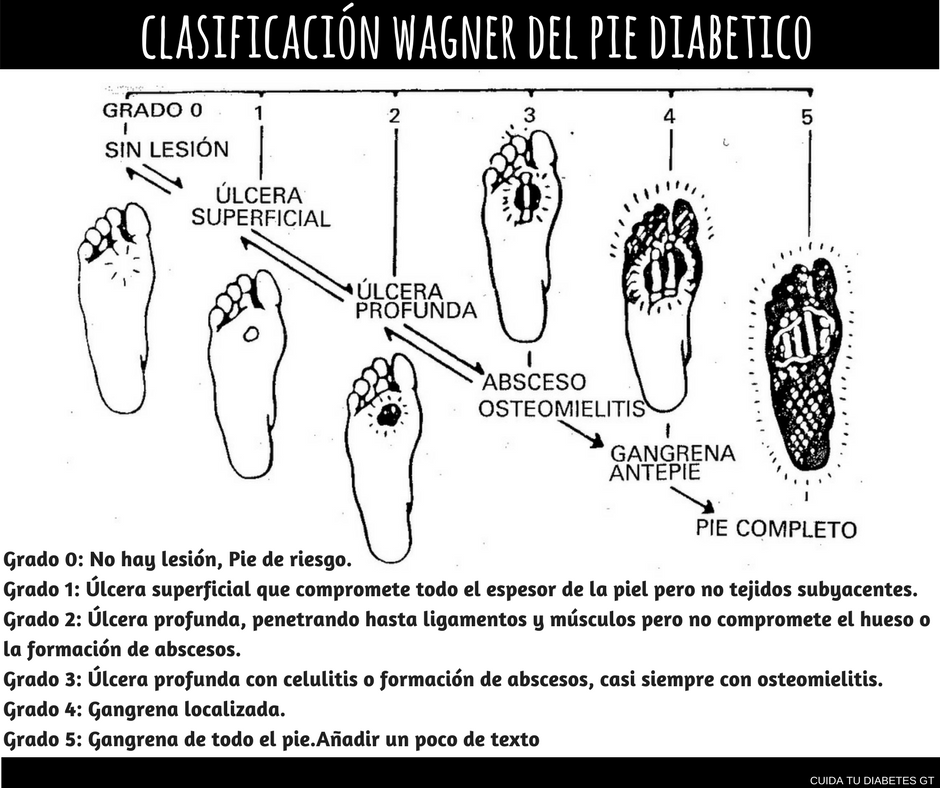 CUIDA TU DIABETES CLASIFICACIÓN WAGNER DEL PIE DIABÉTICO