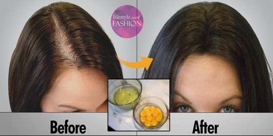 Home Remedies For Hair Loss Reduce Hair Fall Naturally