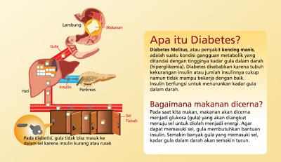 Tahukah Anda?: Diabetes