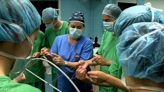 Magyarországon az elmúlt évben 23 ezer szívbetegnél kellett katéteres műtéttel szívkoszorúér-tágítást, úgynevezett stent-beültetést végezni. Ilyenkor a szűkület vagy elzáródás megszüntetése érdekében speciális henger alakú fémhálót, úgynevezett „stent”-et ültetnek a betegbe. Új innovációként 2012 óta Magyarországon használnak már felszívódó műanyag stentet is, itthon elsőként ezt is a Semmelweis Egyetemhez tartozó Városmajori Szív és Érgyógyászati Klinikán alkalmazták.