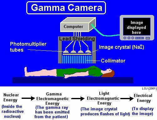 sentinel-lymph-node-detection-gamma-probe-europrobe3-capintec