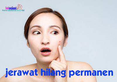 mengobati jerawat secara alami, asuransi jiwa, life insurance, ioisehat, ioi sehat, portal kesehatan, life insurance quotes online, sehat alami inilah tips mengobati jerawat secara alami dengan hasil permanen