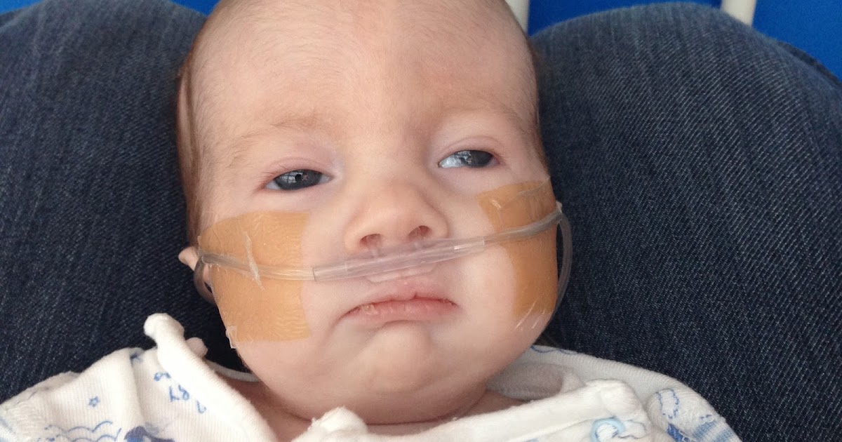 NICU Basics Respiratory support Rumer's Rainbow