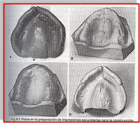 MATERIALES DENTALES FES