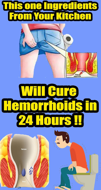 THIS SIMPLE REMEDY CAN CURE YOUR HEMORRHOIDS IN JUST 20 MINUTES !!!