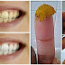 SEA SU PROPIO DENTISTA! CURAR LAS CARIES, ENFERMEDAD DE LAS ENCÍAS, Y BLANQUEAR LOS DIENTES CON PASTA DE DIENTES ESTE NATURAL HECHO EN CASA !!!
