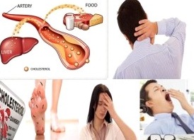 ciri ciri penyakit asam urat, kolesterol dan rematik serta cara mengobatinya ciri ciri penyakit asam urat, kolesterol dan rematik serta cara mengobatinya
