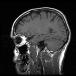An appallingly incompetent psychological study involving religion, the brain, and an MRI raises serious questions.