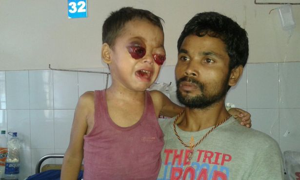 NGERI! Mata Menonjol Seperti Mau Keluar, Ternyata Inilah Gejala Awalnya NGERI! Mata Menonjol Seperti Mau Keluar, Ternyata Inilah Gejala Awalnya