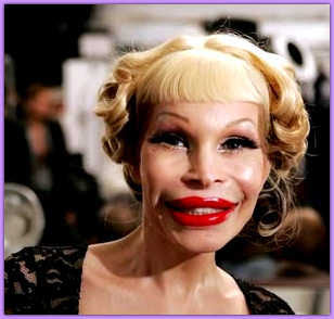 Celebreties Plastic Surgery: Celebrity Plastic Surgery