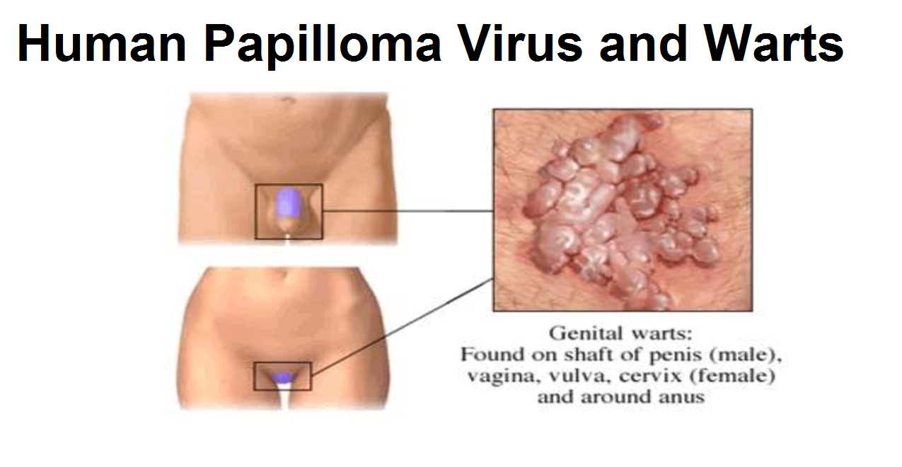 herpes genital papilloma