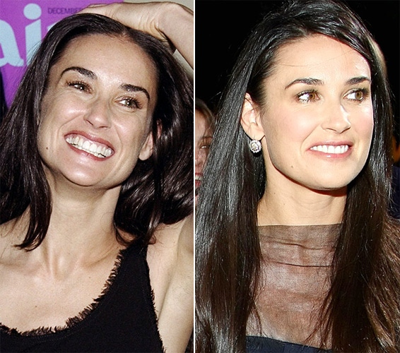 Demi Moore Before And After