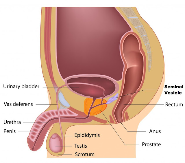 These Are The Early Signs Of Prostate Cancer That You Should Know!