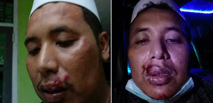 Ketua FPI Bogor Raya Habib Hasan bin Alwi Assegaf Diserang Usai Ceramah di Jampang!